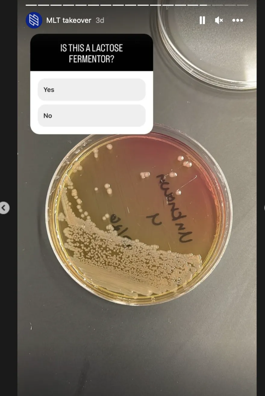 lactose poll question 