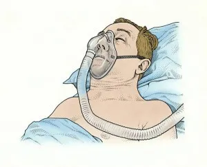 man with narcolepsy